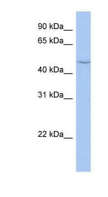 Western Blot: CYP27C1 Antibody [NBP1-56523]