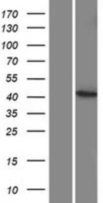 Western Blot: CYP27C1 Overexpression Lysate [NBP2-08955]