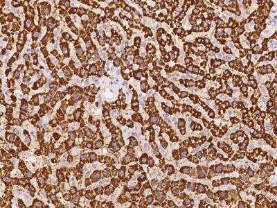 Immunohistochemistry-Paraffin: CYP2A13 Antibody [NBP3-06099]