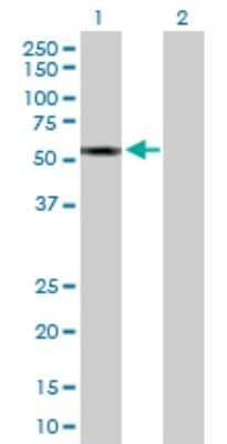 Western Blot: CYP2A13 Antibody [H00001553-D01P]