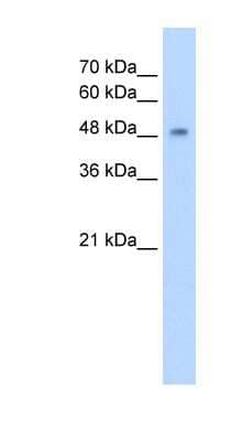 Western Blot: CYP2A13 Antibody [NBP1-62400]