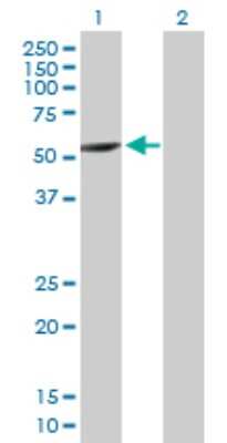 Western Blot: CYP2A7 Antibody [H00001549-B01P]