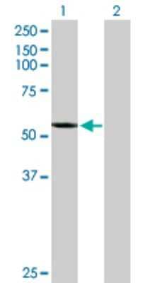 Western Blot: CYP2A7 Antibody [H00001549-D01P]