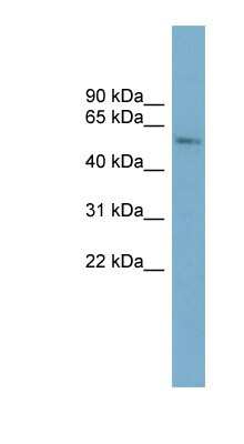 Western Blot: CYP2A7 Antibody [NBP1-62682]