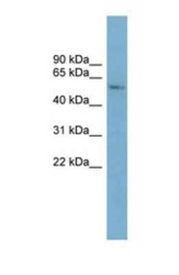 Western Blot: CYP2A7 Antibody [NBP1-69676]