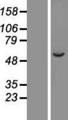 Western Blot: CYP2A7 Overexpression Lysate [NBP2-06209]