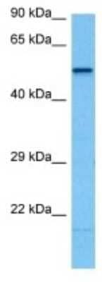 Western Blot: CYP2C70 Antibody [NBP3-10165]