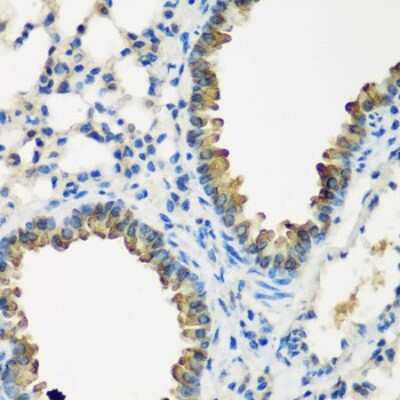 Immunohistochemistry-Paraffin: CYP2F1 Antibody - BSA Free [NBP2-92810]