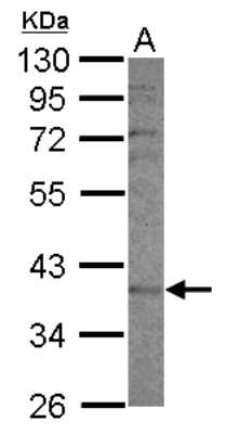 Western Blot: CYP2F1 Antibody [NBP2-14922]