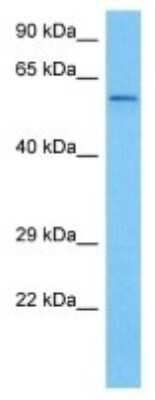 Western Blot: CYP2J5 Antibody [NBP3-10137]