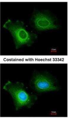 Immunocytochemistry/ Immunofluorescence: CYP2R1 Antibody [NBP1-32883]