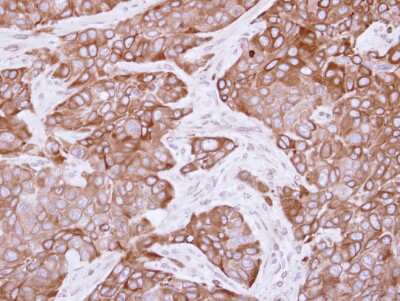 Immunohistochemistry-Paraffin: CYP2R1 Antibody [NBP1-32883]