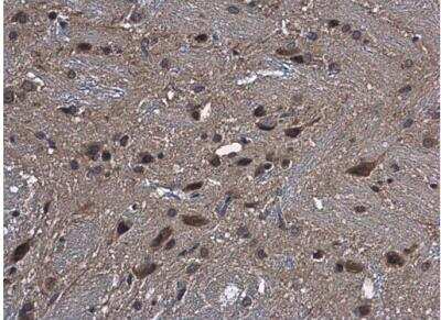 Immunohistochemistry-Paraffin: CYP2R1 Antibody [NBP1-32883]