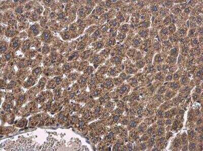 Immunohistochemistry-Paraffin: CYP2R1 Antibody [NBP1-32883]