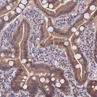 Immunohistochemistry-Paraffin: CYP2R1 Antibody [NBP2-13895]