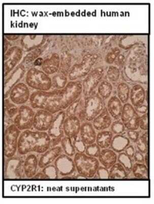 Immunohistochemistry: CYP2R1 Antibody (M26-P6H1) - BSA Free [NBP2-50204]