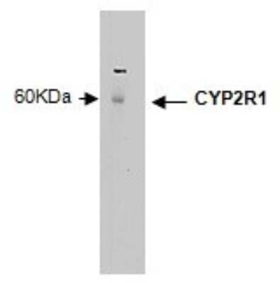 Western Blot: CYP2R1 Antibody (M26-P6H1)BSA Free [NBP2-50204]