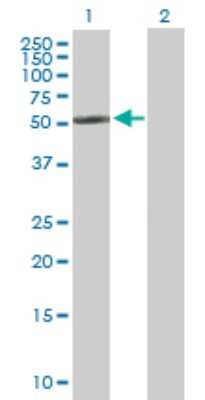 Western Blot: CYP2R1 Antibody [H00120227-B01P]