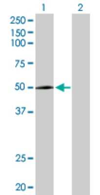 Western Blot: CYP2R1 Antibody [H00120227-D01P]