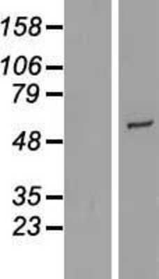 Western Blot: CYP2R1 Overexpression Lysate [NBL1-09689]