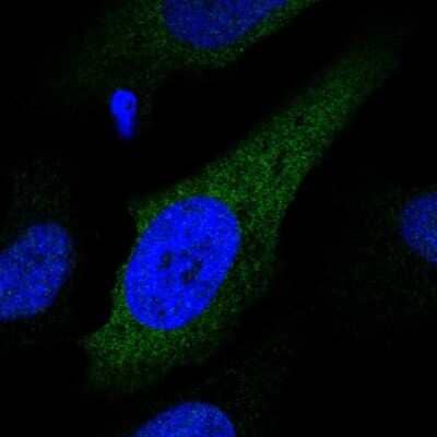 Immunocytochemistry/ Immunofluorescence: CYP2S1 Antibody [NBP2-55469]