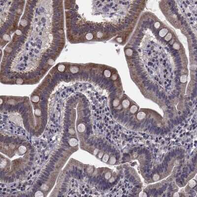 Immunohistochemistry: CYP2S1 Antibody [NBP2-68881]