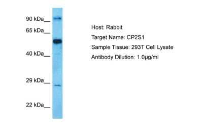 Western Blot: CYP2S1 Antibody [NBP2-84747]