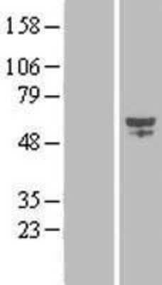 Western Blot: CYP2S1 Overexpression Lysate [NBL1-09690]