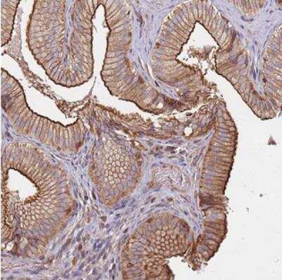 Immunohistochemistry: CYP2U1 Antibody [NBP2-30522]