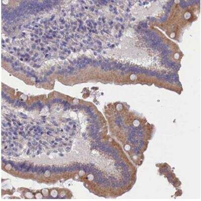 Immunohistochemistry: CYP2U1 Antibody [NBP2-30991]