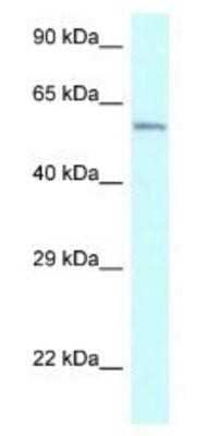 Western Blot: CYP2U1 Antibody [NBP1-79914]