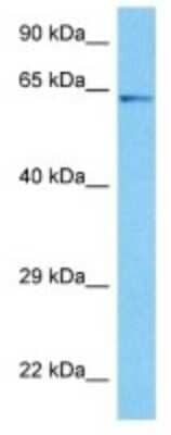 Western Blot: CYP2U1 Antibody [NBP3-10818]