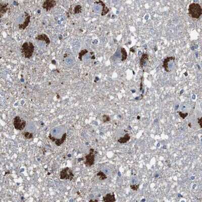 Immunohistochemistry-Paraffin: CYP2W1 Antibody [NBP1-83659]