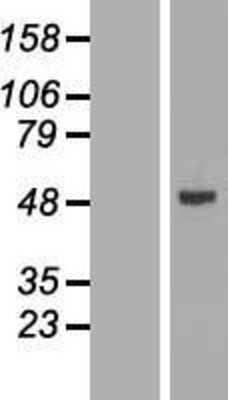 Western Blot: CYP2W1 Overexpression Lysate [NBL1-09691]