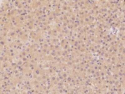 Immunohistochemistry: CYP39A1 Antibody [NBP2-97435]