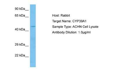 Western Blot: CYP39A1 Antibody [NBP2-83988]