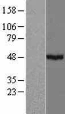 Western Blot: CYP39A1 Overexpression Lysate [NBP2-07001]