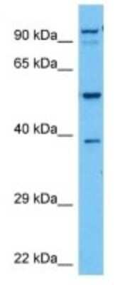 Western Blot: CYP3A25 Antibody [NBP3-10282]