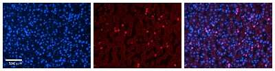 Immunohistochemistry: CYP3A43 Antibody [NBP1-69370]