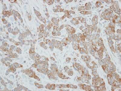 Immunohistochemistry-Paraffin: CYP3A43 Antibody [NBP2-16064]