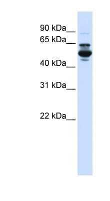 Western Blot: CYP3A43 Antibody [NBP1-62393]