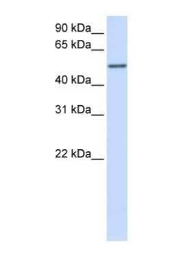 Western Blot: CYP3A43 Antibody [NBP1-69370]