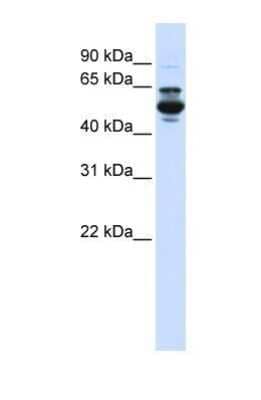 Western Blot: CYP3A43 Antibody [NBP1-69413]