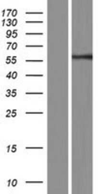 Western Blot: CYP3A43 Overexpression Lysate [NBP2-06397]