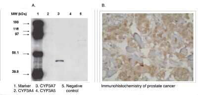 Western Blot: CYP3A7 Antibody (F19 P2 H2) [NBP3-11914]