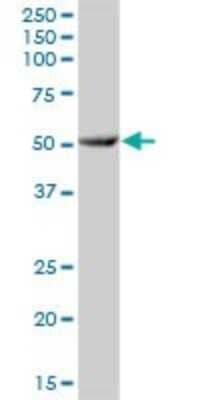 Western Blot: CYP3A7 Antibody [H00001551-B01P]