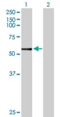 Western Blot: CYP3A7 Antibody [H00001551-D01P]