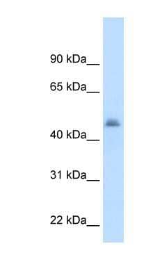 Western Blot: CYP3A7 Antibody [NBP1-62387]