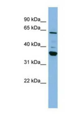 Western Blot: CYP3A7 Antibody [NBP1-69670]