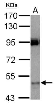 Western Blot: CYP3A7 Antibody [NBP2-16065]